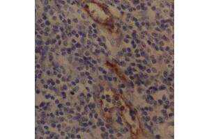 Immunohistochemistry (IHC) image for anti-Selectin P (Granule Membrane Protein 140kDa, Antigen CD62) (SELP) antibody (ABIN2472250) (P-Selectin antibody)