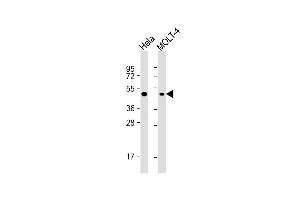 Western Blot at 1:1000 dilution Lane 1: Hela whole cell lysate Lane 2: MOLT-4 whole cell lysate Lysates/proteins at 20 ug per lane. (MEK2 antibody  (AA 372-400))