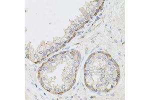 Immunohistochemistry of paraffin-embedded human prostate using CIB1 antibody (ABIN1871861) at dilution of 1:100 (40x lens). (CIB1 antibody)