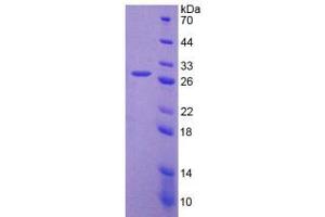 Image no. 1 for Fibroblast Activation Protein, alpha (FAP) (AA 542-761) protein (His tag) (ABIN4989278) (FAP Protein (AA 542-761) (His tag))