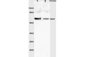 L1 human colon carcinoma lysates L2 mouse embryo lysates probed with Anti phospho-C-fos(Thr232) Polyclonal Antibody, Unconjugated (ABIN684913) at 1:200 in 4 °C. (c-FOS antibody  (pThr232))