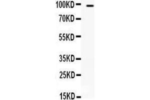 Anti- TLR5 Picoband antibody, Western blotting All lanes: Anti TLR5  at 0. (TLR5 antibody  (C-Term))