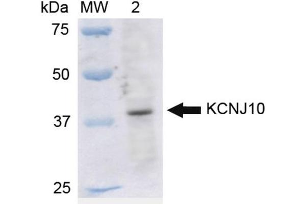 KCNJ10 antibody  (FITC)