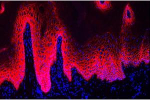 human oesophagus (courtesy of L. (Plakophilin 1 antibody)