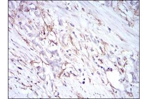 Immunohistochemistry (IHC) image for anti-CD14 (CD14) (AA 20-214) antibody (ABIN1724926)