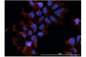 Immunofluorescence  staining of huSSECTM cell line overexpressing hFcRn-EGFP using  clone DVN24 at 15µg/ml and Texas Red™ conjugated anti-mouse secondary. (FcRn antibody)