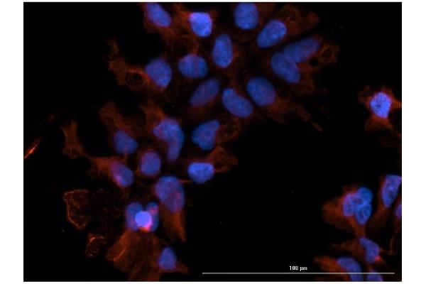 FcRn antibody