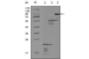 Western Blot showing ERBB3 antibody used against truncated Trx-ERBB3 recombinant protein (1), MBP-ERBB3 (aa1175-1275) recombinant protein (2) and truncated ERBB3 (aa665-1342)-hIgGFc transfected CH0-K1 cell lysate (3). (ERBB3 antibody  (AA 1175-1275))