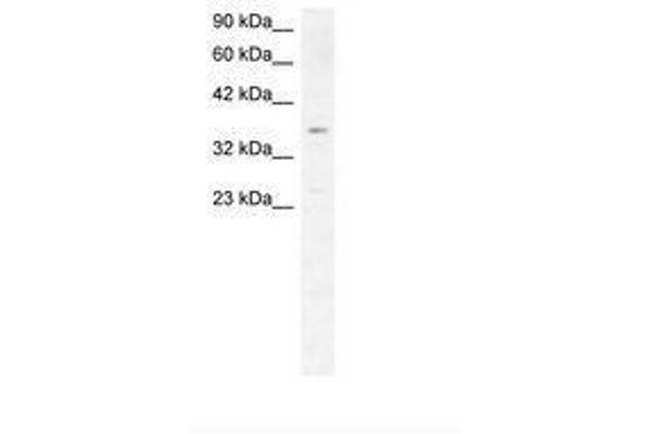 SCD antibody  (AA 190-239)