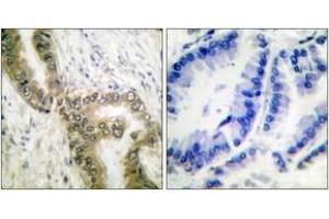 Immunohistochemistry (IHC) image for anti-Tumor Protein P53 (TP53) (acLys386) antibody (ABIN2890735) (p53 antibody  (acLys386))