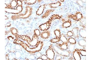 Immunohistochemistry (IHC) image for anti-Cadherin-16 (CDH16) antibody (ABIN6939024)