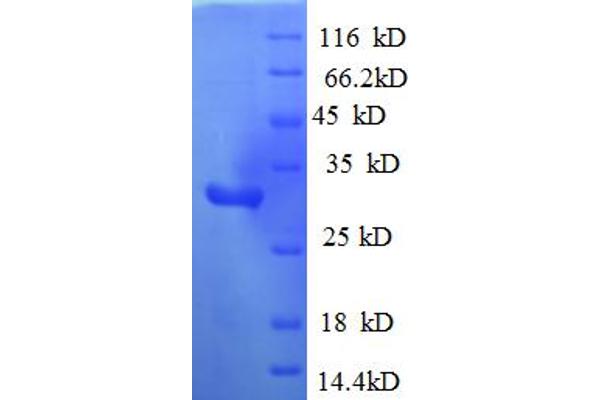 MAP3K1 Protein (AA 1216-1493, partial) (His tag)