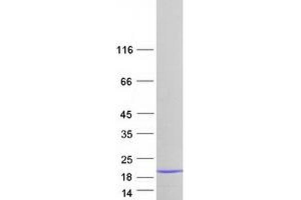 LSM3 Protein (Myc-DYKDDDDK Tag)