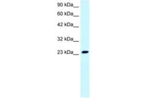 Western Blotting (WB) image for anti-FLJ11730 antibody (ABIN2460699) (FLJ11730 antibody)