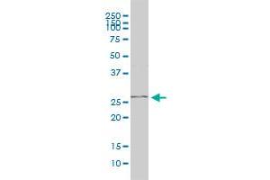 PGAM1 monoclonal antibody (M01), clone 2G1-A6 Western Blot analysis of PGAM1 expression in Jurkat . (PGAM1 antibody  (AA 1-254))