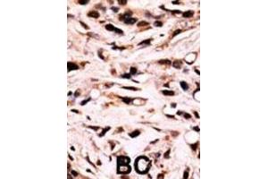 Immunohistochemistry (IHC) image for anti-SMAD Family Member 4 (SMAD4) (pThr277) antibody (ABIN3001788) (SMAD4 antibody  (pThr277))