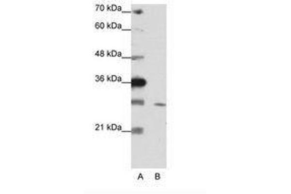 ZNF397 antibody  (C-Term)