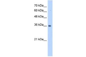 TRUB2 antibody used at 1 ug/ml to detect target protein. (TRUB2 antibody  (N-Term))