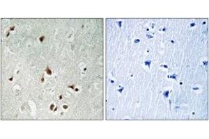Immunohistochemistry analysis of paraffin-embedded human brain tissue, using HDAC5 (Ab-259) Antibody. (HDAC5 antibody  (AA 225-274))