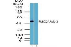 Image no. 1 for anti-Runt-Related Transcription Factor 2 (RUNX2) (AA 250-300) antibody (ABIN207712) (RUNX2 antibody  (AA 250-300))