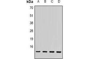 Western blot analysis of SSNA1 expression in PC3 (A), MCF7 (B), mouse spleen (C), rat brain (D) whole cell lysates. (SSNA1 antibody)