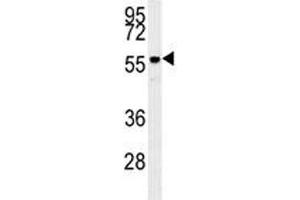 Anti-AKT2 antibody western blot analysis in mouse brain tissue lysate (AKT2 antibody)