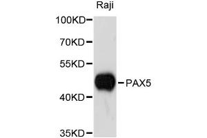 Western blot analysis of extracts of Raji cells, using PAX5 antibody. (PAX5 antibody)
