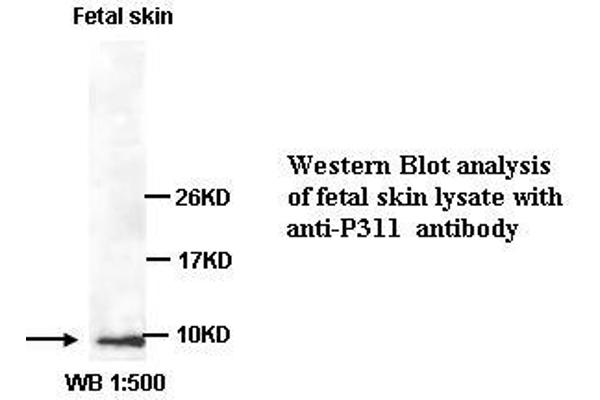 NREP antibody  (C-Term)