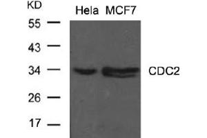 Image no. 2 for anti-Cyclin-Dependent Kinase 1 (CDK1) (Tyr15) antibody (ABIN197483) (CDK1 antibody  (Tyr15))