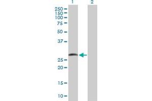 Western Blot analysis of SMAD9 expression in transfected 293T cell line by SMAD9 MaxPab polyclonal antibody. (SMAD9 antibody  (AA 1-225))