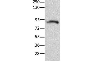 Western Blotting (WB) image for anti-Potassium Voltage-Gated Channel, Subfamily H (Eag-Related), Member 2 (KCNH2) antibody (ABIN2426046) (KCNH2 antibody)