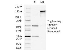 SDS-PAGE Analysis Purified Insulin Mouse Monoclonal Antibody (E2-E3+2D11-H5). (Insulin antibody)