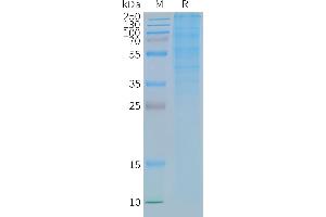 GLP1R Protéine