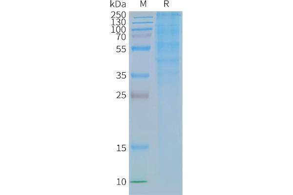 GLP1R Protéine