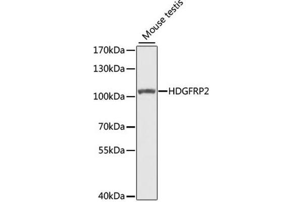 HDGFRP2 antibody  (AA 501-670)