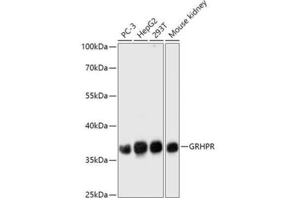 GRHPR antibody  (AA 100-328)