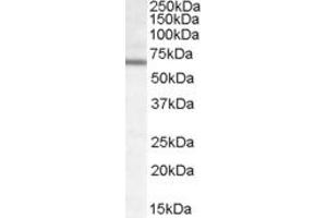 Western Blotting (WB) image for anti-Dachshund 2 (DACH2) (Internal Region) antibody (ABIN2466501) (DACH2 antibody  (Internal Region))