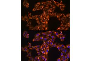 Immunohistochemistry of paraffin-embedded mouse kidney using eEF1 Rabbit mAb (1545) at dilution of 1:200 (40x lens). (eEF1A1 antibody)
