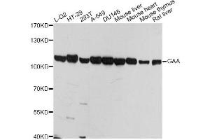 Western blot analysis of extracts of various cell lines, using GAA antibody. (GAA antibody)