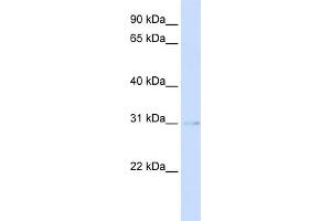 WB Suggested Anti-PVRIG Antibody Titration:  0. (PVRIG antibody  (Middle Region))