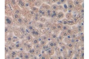 DAB staining on IHC-P; Samples: Mouse Liver Tissue (CCL4 antibody  (AA 24-92))