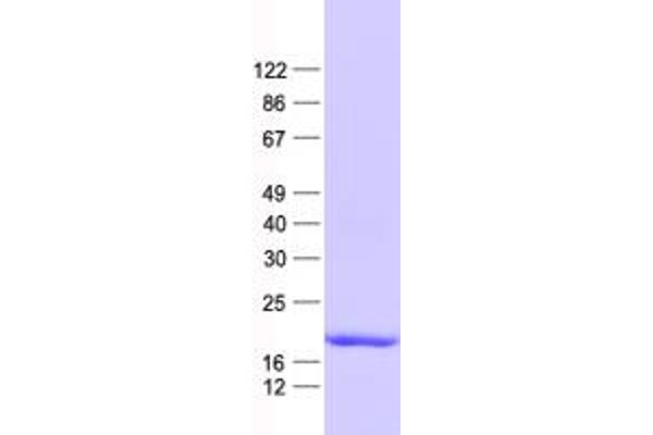 DUSP22 Protein (His tag)