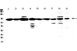 Western blot analysis of XRCC1 using anti-XRCC1 antibody . (XRCC1 antibody  (AA 538-633))
