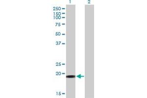 Western Blot analysis of YSK4 expression in transfected 293T cell line by YSK4 MaxPab polyclonal antibody. (MAP3K19 antibody  (AA 1-168))