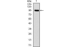 Western Blotting (WB) image for anti-Neurofilament, Light Polypeptide (NEFL) antibody (ABIN969548)