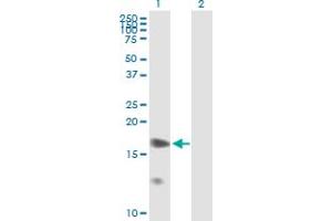 Western Blot analysis of PPP1R7 expression in transfected 293T cell line by PPP1R7 MaxPab polyclonal antibody. (PPP1R7 antibody  (AA 1-360))