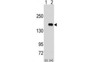 Western Blotting (WB) image for anti-Pumilio Homolog 2 (Drosophila) (PUM2) antibody (ABIN3003295) (PUM2 antibody)