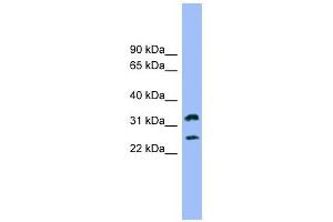 FCER1A antibody used at 1 ug/ml to detect target protein. (Fc epsilon RI/FCER1A antibody  (N-Term))