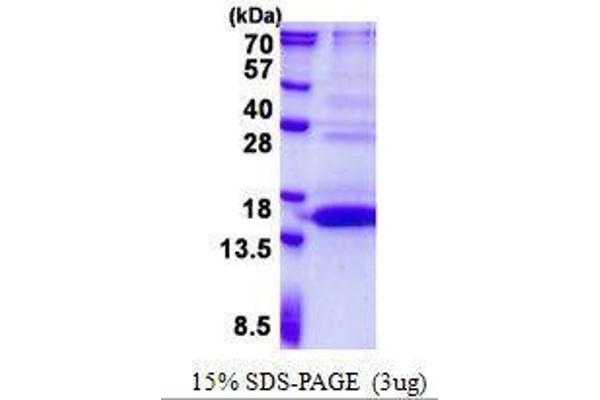 UFSP1 Protein