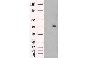 Western Blotting (WB) image for anti-CD4 (CD4) antibody (ABIN1497295) (CD4 antibody)